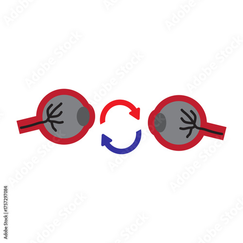 Eye Transplant