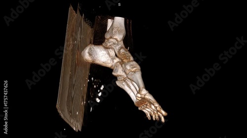 High-quality LT Ankle Foot Plain Bone Thin VR movie revealing detailed skeletal anatomy and joint structure. This 3D medical visualization showcases bone alignment and mobility for diagnostic