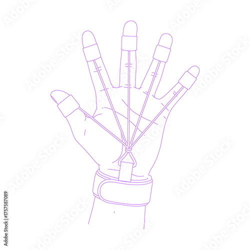 Line art illustration of a hand wearing a finger extension band for rehabilitation