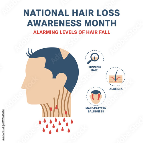 National Hair Loss Awareness Month focuses on male-pattern baldness, alopecia, thinning hair, and alarming levels of hair fall