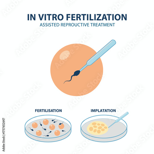 Assisted reproductive treatment involves in vitro fertilization, artificial insemination, and the injection of sperm into an egg cell