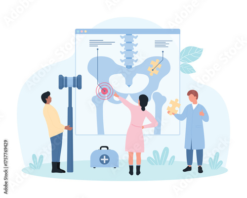 Osteoporosis, diagnosis, treatment and rehabilitation in rheumatology vector illustration. Cartoon tiny people study human hip joint on medical anatomy chart, orthopedist holding bone calcium puzzle