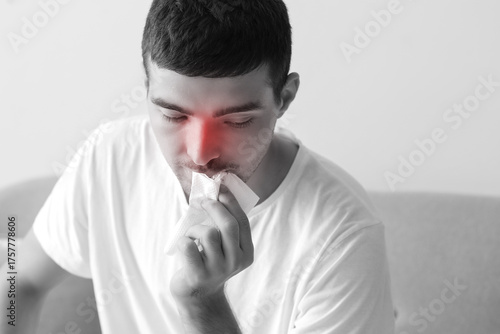 Young man wiping nosebleed ...