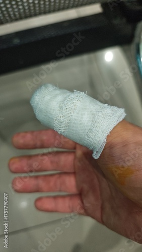 Injured hand with bandage 