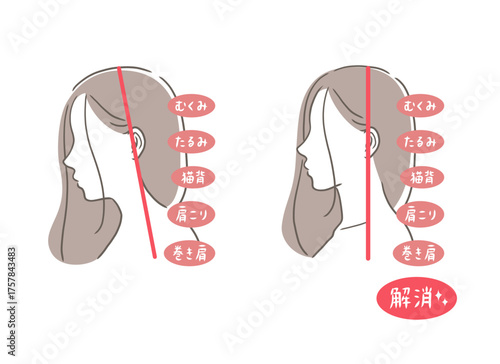 ストレートネックとまっすぐの姿勢の女性の比較イラストセット