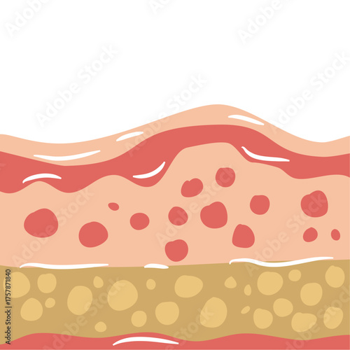 human skin layers vector