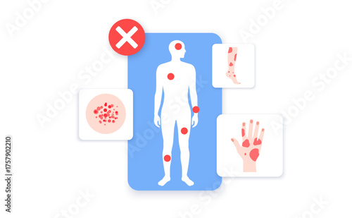 Dermatitis skin disease