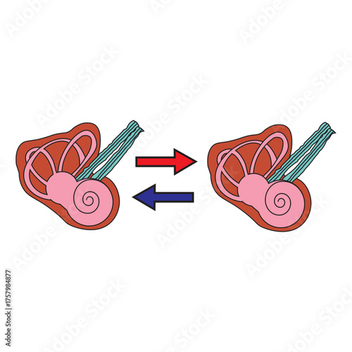 Cochlea Implant 