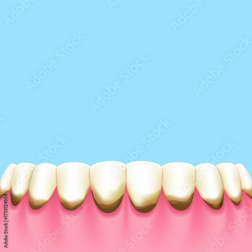Lower teeth (Decay) - Text box sign blank banner (square) illustration vector design. Dental care concept.