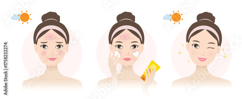 Cute woman treating damaged skin with sunscreen and steps skincare routine vector set illustration. Before and after protecting from UV rays. Skincare and beauty routine and self care concept.