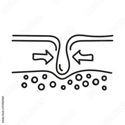 Diagram illustrating pore cleansing and skin treatment with arrows showing suction and fluid extraction