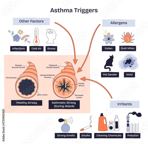Asthma triggers overview shows airway narrowing with key culprits, pollen, smoke, dust mites, aiding prevention. Doodle style diagram