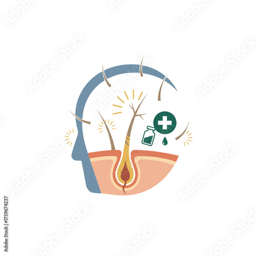Hair follicle: male-pattern baldness, alopecia, thinning hair, and alarming hair loss levels; concept includes split ends, dryness or sun protection, and medical hair care treatment