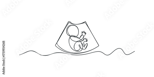 Continuous line drawing of fetus in womb with medical scan lines