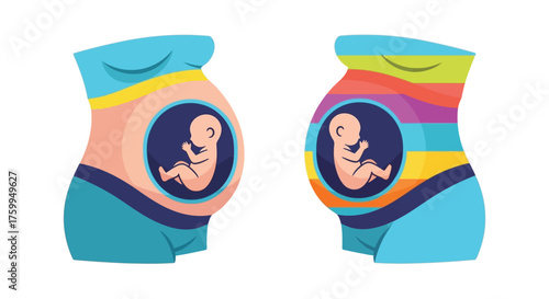 Visualizing twin pregnancies two pregnant bellies with rainbow colored bands