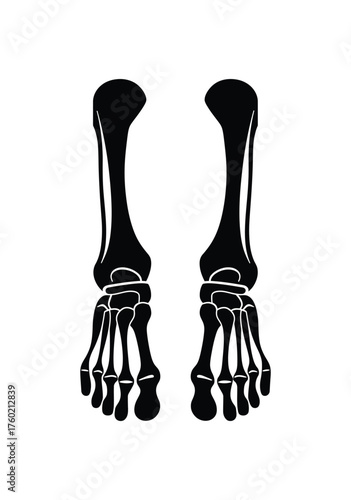 Two black human feet skeleton visible against the white background show distinct features