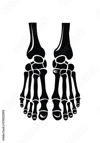 Two human feet with bone structure are displayed in a black silhouette against white