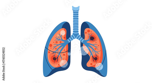 Illustration of Human Lungs with Cancer Cells A Medical and Anatomical Perspective