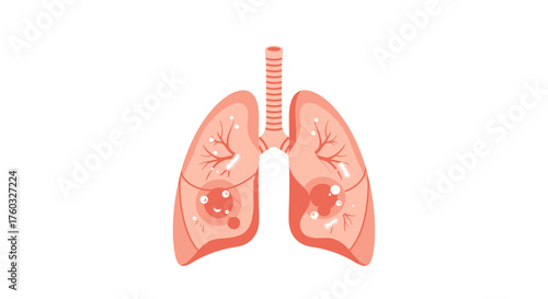 Vector illustration of unhealthy human lungs with signs of disease, tumors, or cancer on a white background.