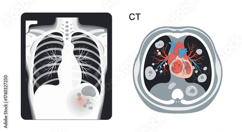 Medical imaging comparison: Chest X-ray and CT scan illustrating internal organs and potential anomalies.