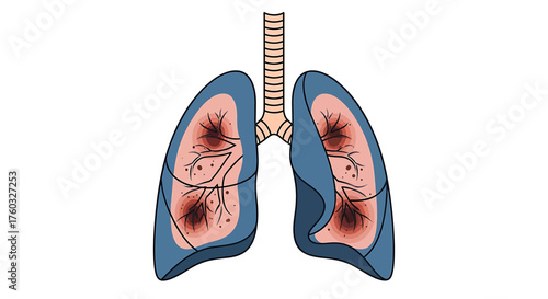 Illustration of lungs with dark spots, possibly indicating a health issue.