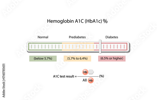 Diabetes Mellitus. Hemoglobin A1C, HbA1c test , HbA1c levels, Glucose sticks to hemoglobin, glycated hemoglobin, up to 120 days. A1C Blood Sugar Test, Infographic, Vector illustration.	