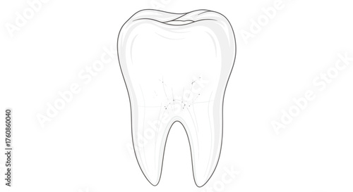 Illustrative dental anatomy depicting a molar with subtle decay for educational purposes