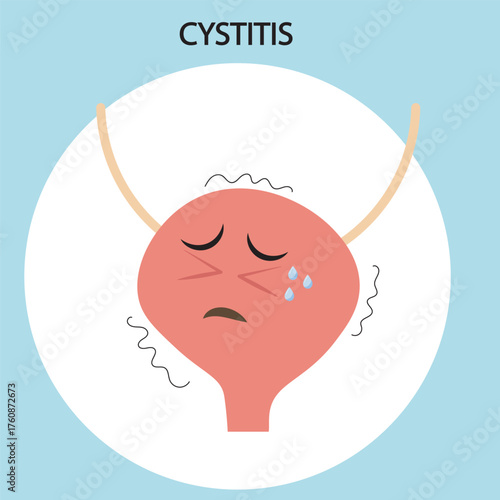 Medical vector illustration of cystitis showing bladder pain, burning urination, urgency, and discomfort. Includes comparisons with urethritis and kidney infection symptoms. crying