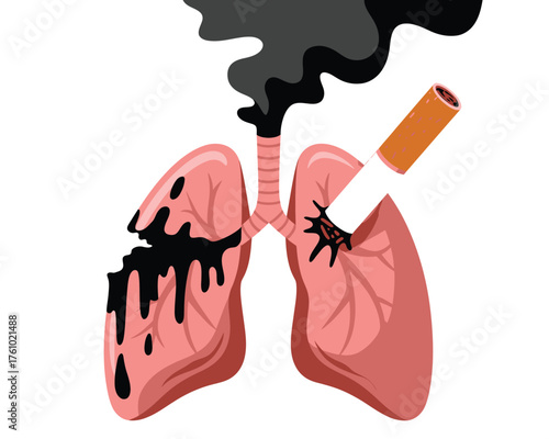 Damaged lungs from smoking cigarette smoke and tar illustration