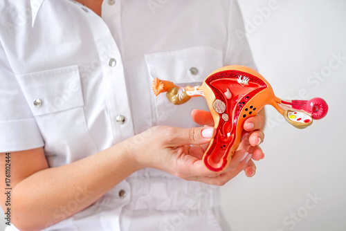Close-up anatomical model of the female uterus with images of cancerous growths and tumors, polyps.