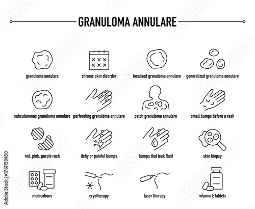 Granuloma Annulare symptoms, diagnostic and treatment vector icon set. Line editable medical icons.