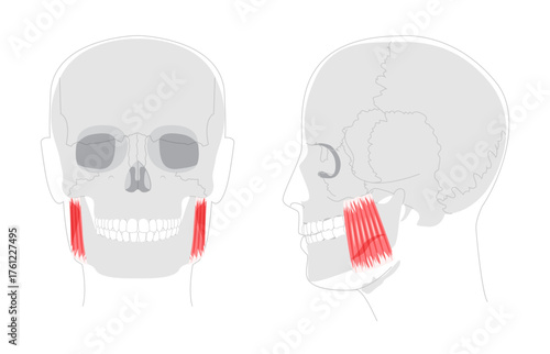 Masseter - Human chewing muscle shown in diagram responsible for elevating the mandible, crucial for biting and grinding, depicted in medical illustration for dental and anatomical education.