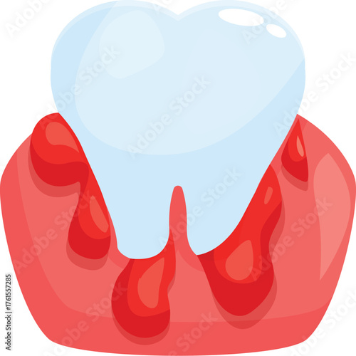 Inflamed gums are bleeding around a single tooth, indicating gingivitis or periodontal disease