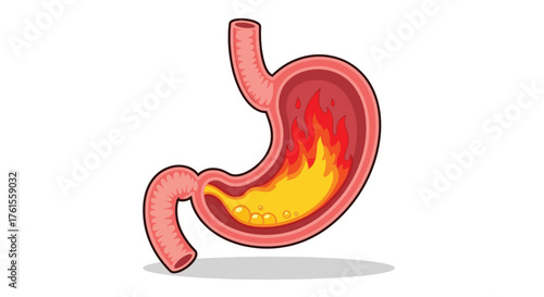 Anatomical Illustration of a Human Stomach with Internal Fire and Acid.