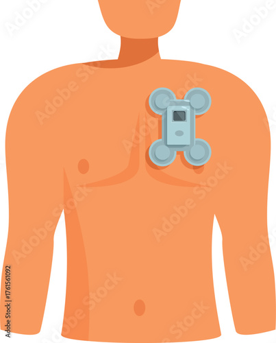 Holter monitor attached to patient's chest, recording heart activity for diagnosis