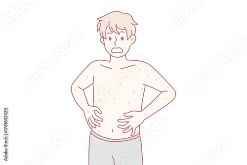 Unhealthy boy with red spots on body suffer from measles or rubella. Anxious unwell man struggle with rash fever, have severe symptoms. Healthcare concept. Flat vector illustration.