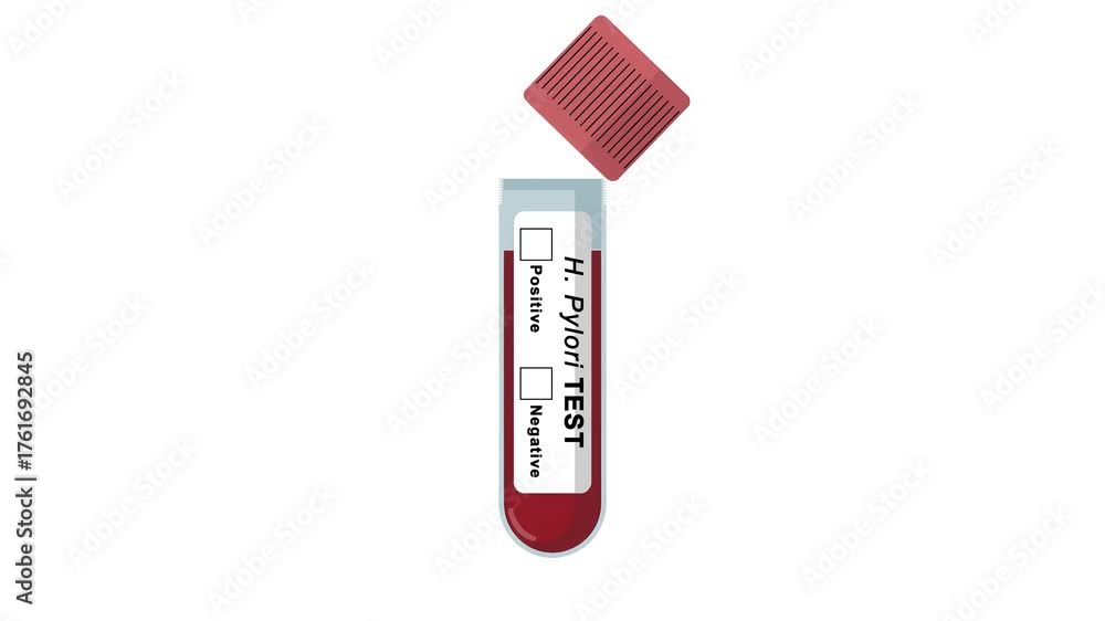 Animated H. pylori test tube showing a negative result with a tick box ...