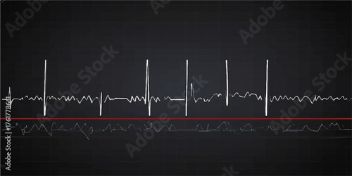 Green line heartbeat ECG cardiogram wave on a medical monitor display chart for pulse rate and health illustration