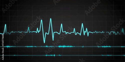 Cardiology illustration showing a green or blue ECG heartbeat line on a medical monitor with a pulse wave graph indicating heart rate