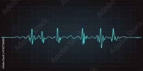 ECG heartbeat line graph on a monitor showing a green life pulse in medicine