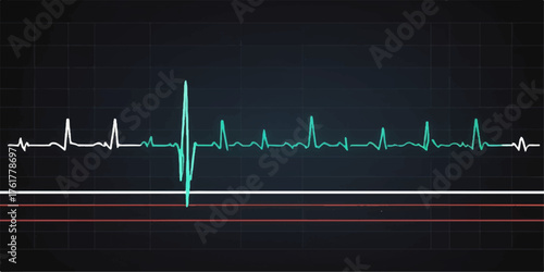 EKG heart monitor displaying a green heartbeat line, illustrating medical technology and cardiology healthcare
