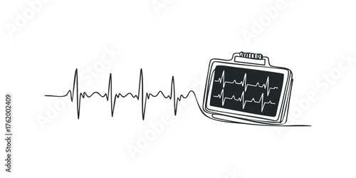 Electrocardiogram monitor displaying heart rhythm graph