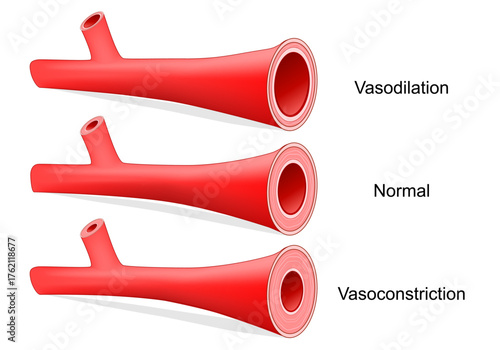Vasoconstriction, Vasodilation, and normal artery. Comparison of normal, constricted, and dilated blood vessels