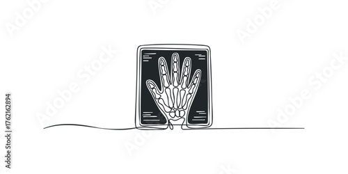 X ray of human hand bones displayed on screen