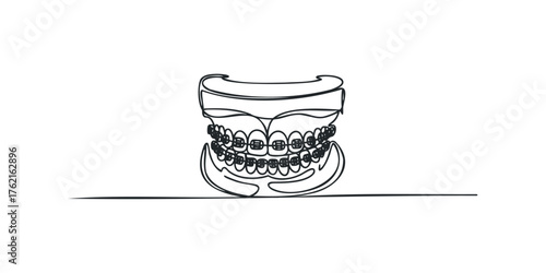 Single Line Drawing of Dental Braces and Teeth