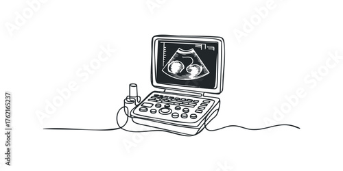 Medical ultrasound machine displaying fetal scan