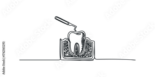 Tooth diagram with dental tool in continuous line style