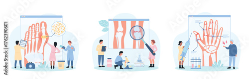Rheumatology set vector illustration. Cartoon tiny people examine joints of human knee, fingers of hand and foot, doctors diagnose rheumatoid arthritis and osteoarthritis, gout for medical treatment