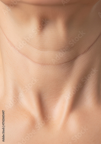 Tech Neck' Horizontal Lines and Crepey Skin