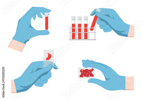 Set of flat design medical vector illustrations showing hands in gloves.
